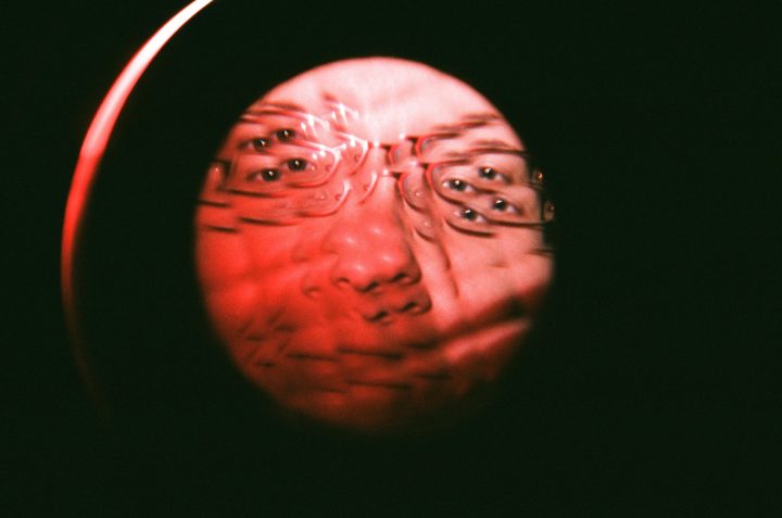 Dor Bug Eye