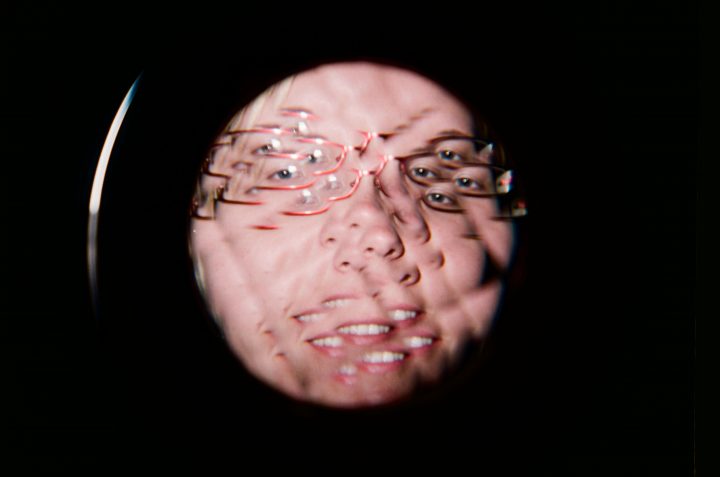 Dor Bug Eye