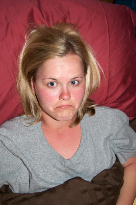 Sunburn :(