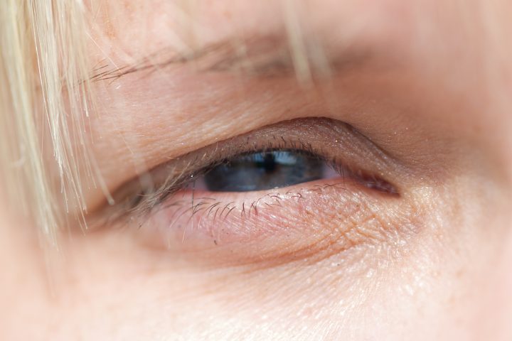 Closeup Of Eye