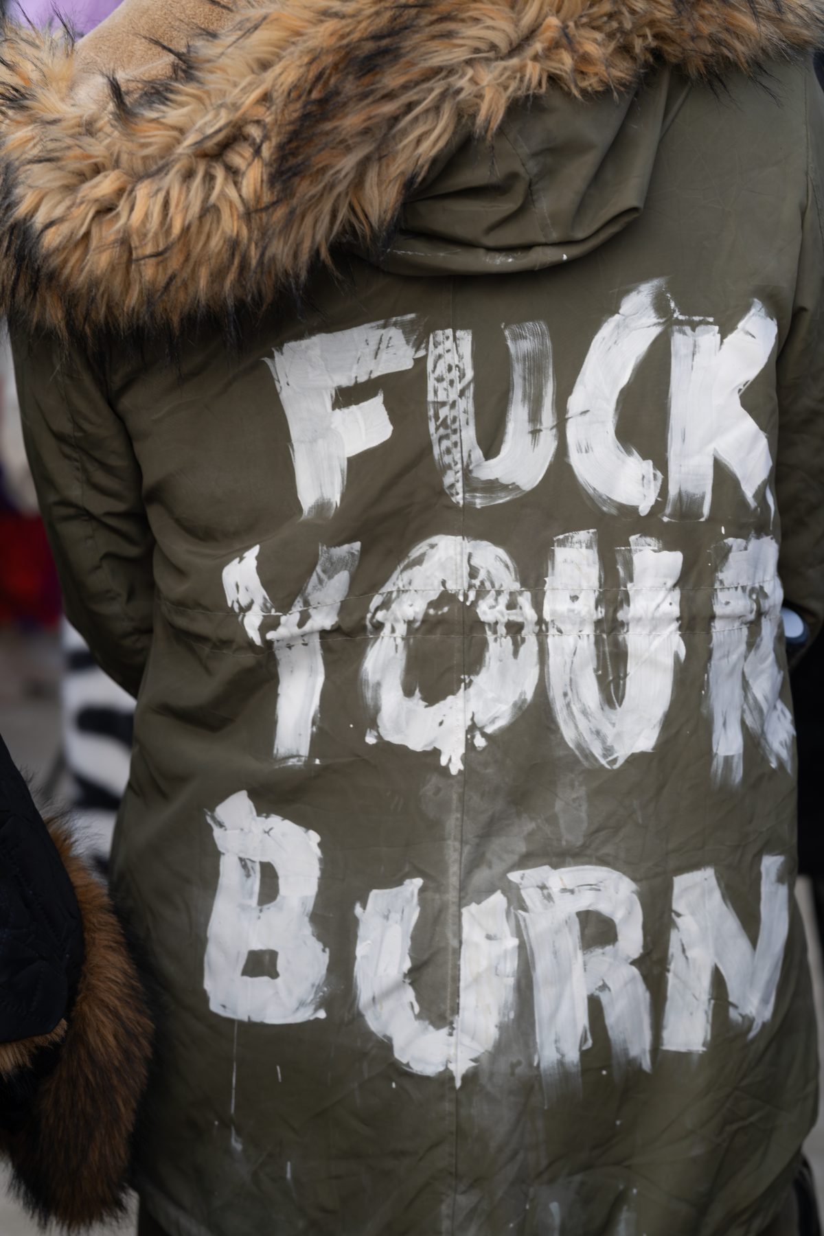 Fuck Your Burn